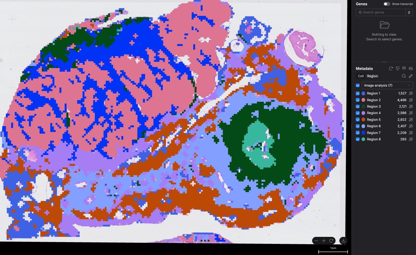 Region segmentation